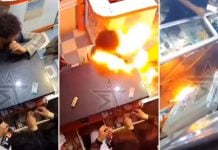 battery exploded boy mouth