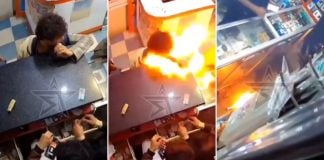 battery exploded boy mouth