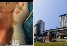 shaanxi hospital patient's genitals