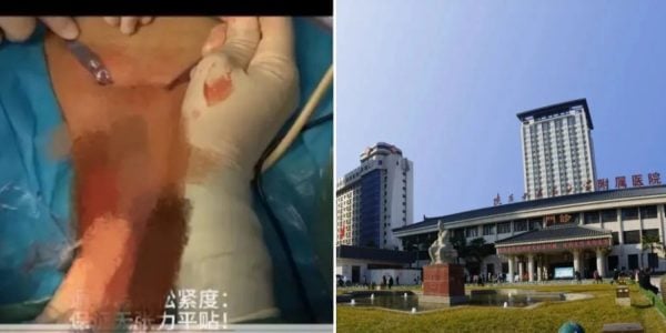 shaanxi hospital patient's genitals