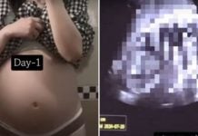 36-week-old fetus abortion