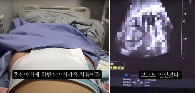 36-week-old fetus abortion (3)