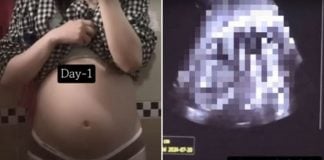 36-week-old fetus abortion