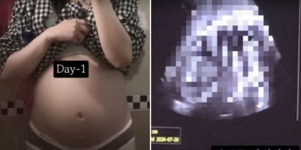 36-week-old fetus abortion