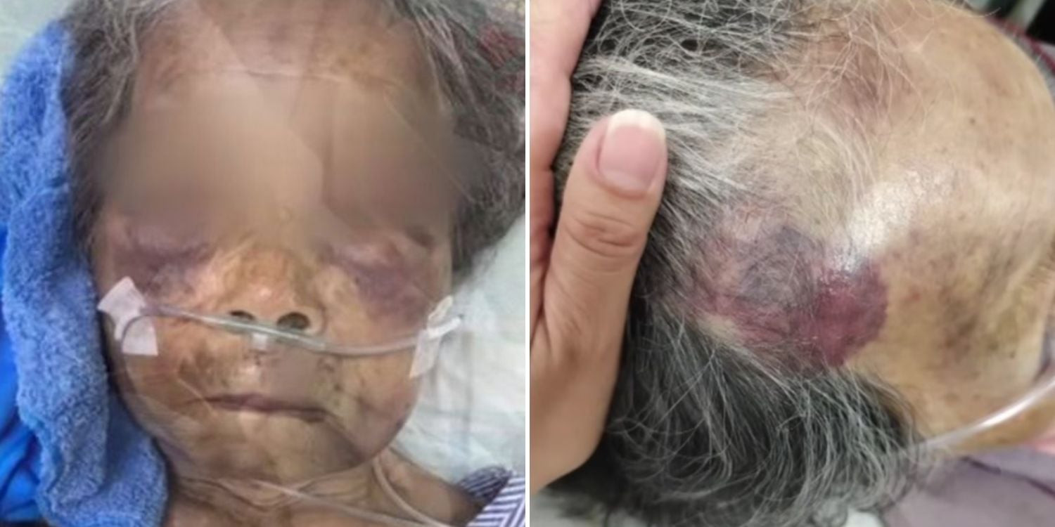 90-year-old assaulted debt