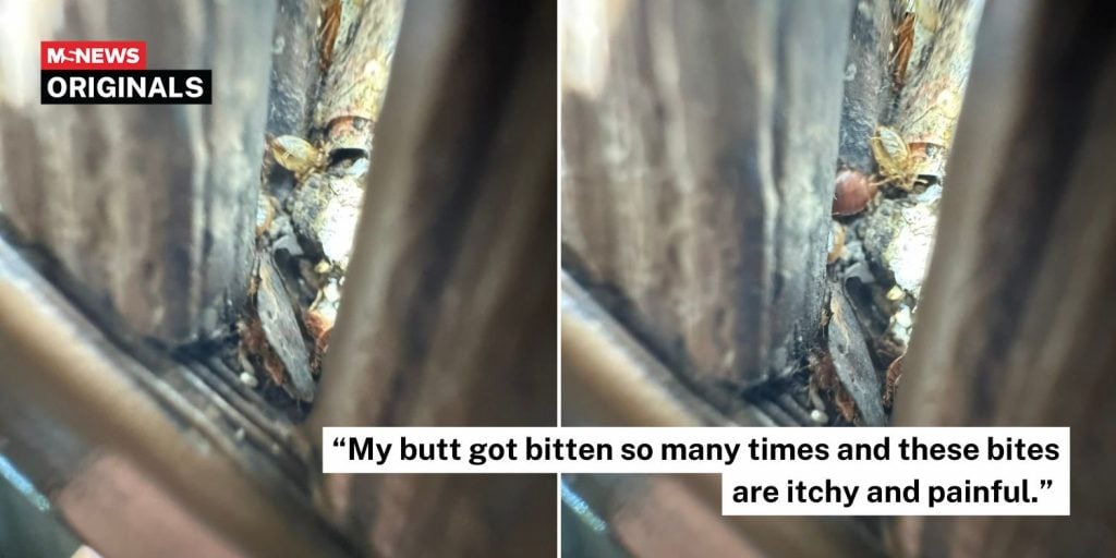 bitten by bedbugs