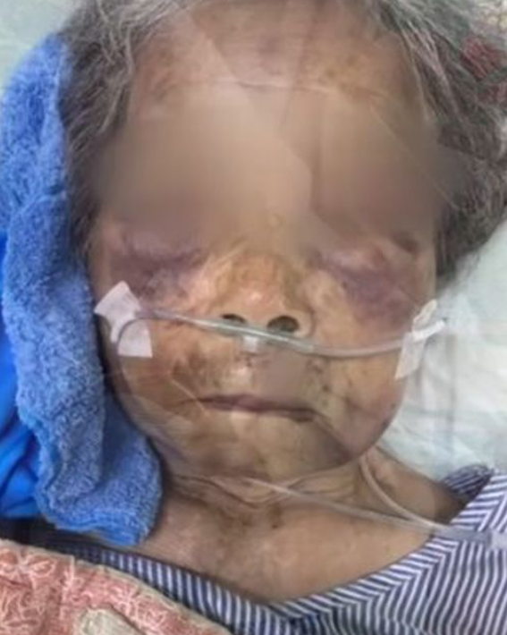 90-year-old assaulting grandson debt