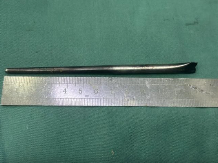 man metal chopstick throat