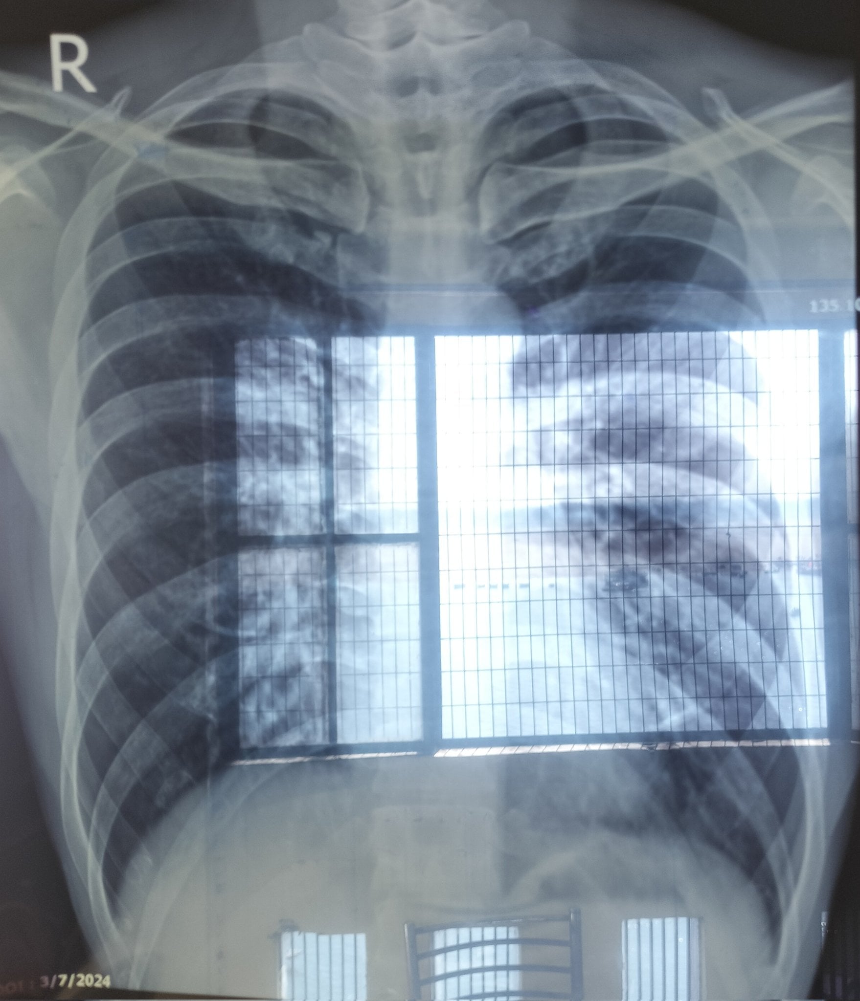 bloggers cow dung india