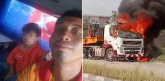 boy burned lorry