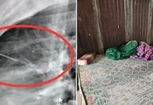 needle close to heart