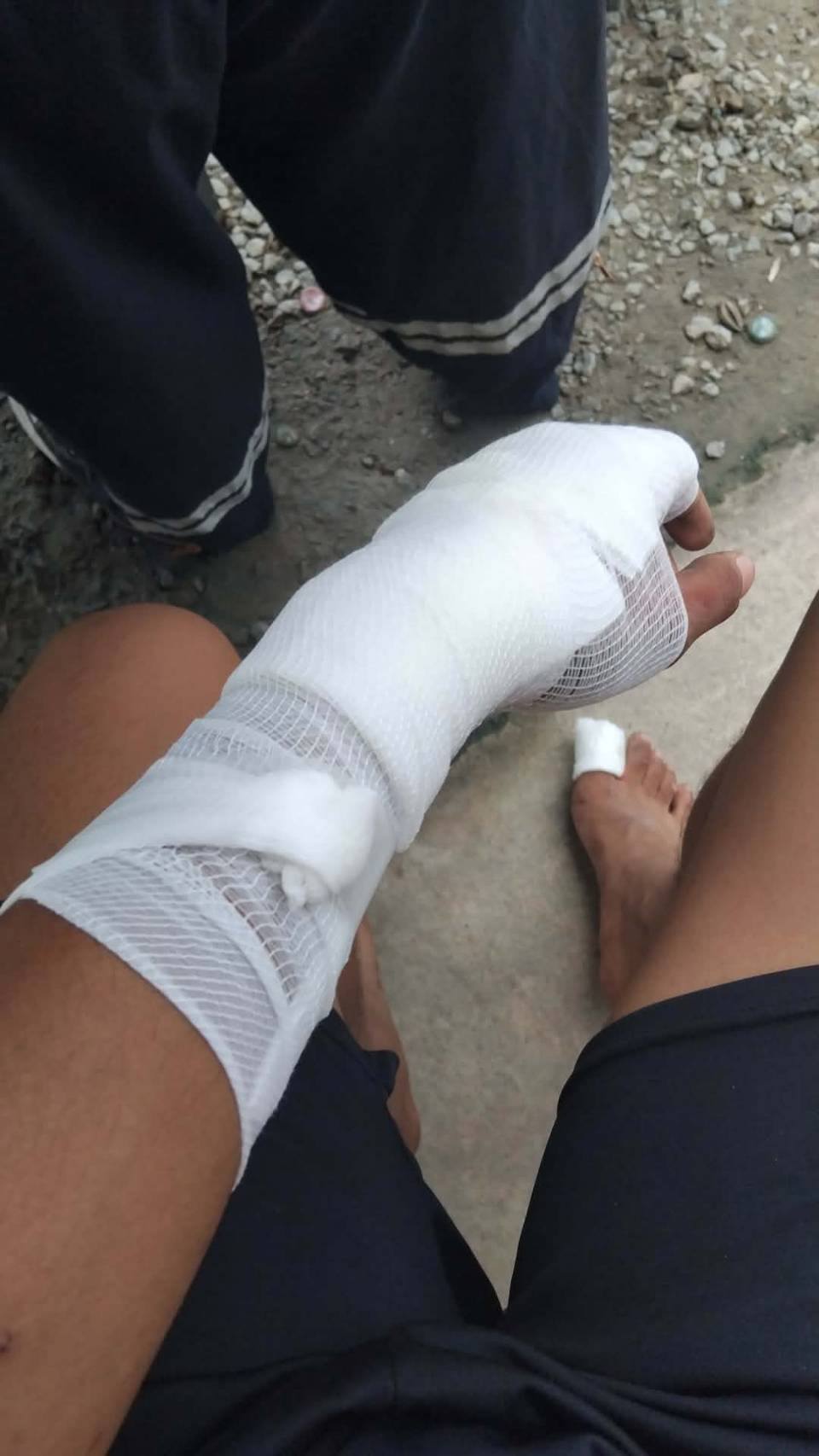 truck chain collision lorry injury