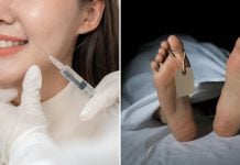 Skin injectables human cadavers