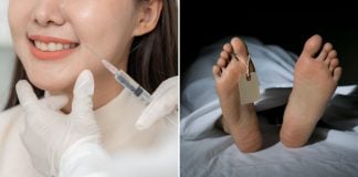 Skin injectables human cadavers