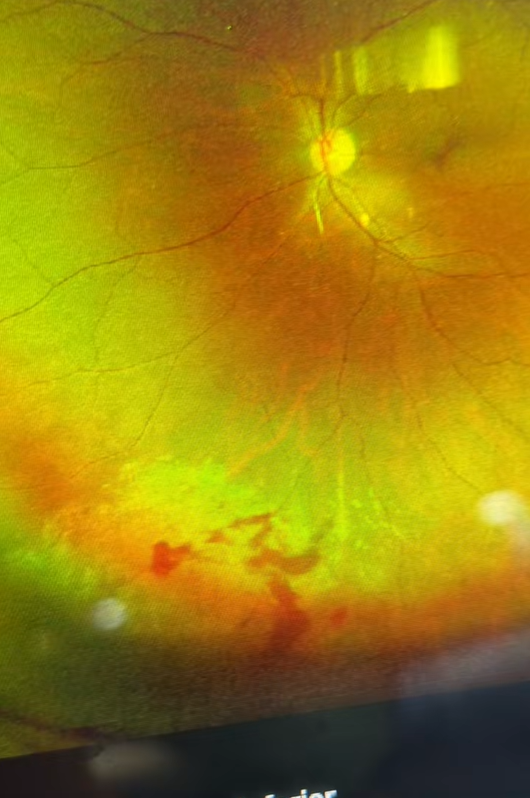 almost went blind songkran (1)