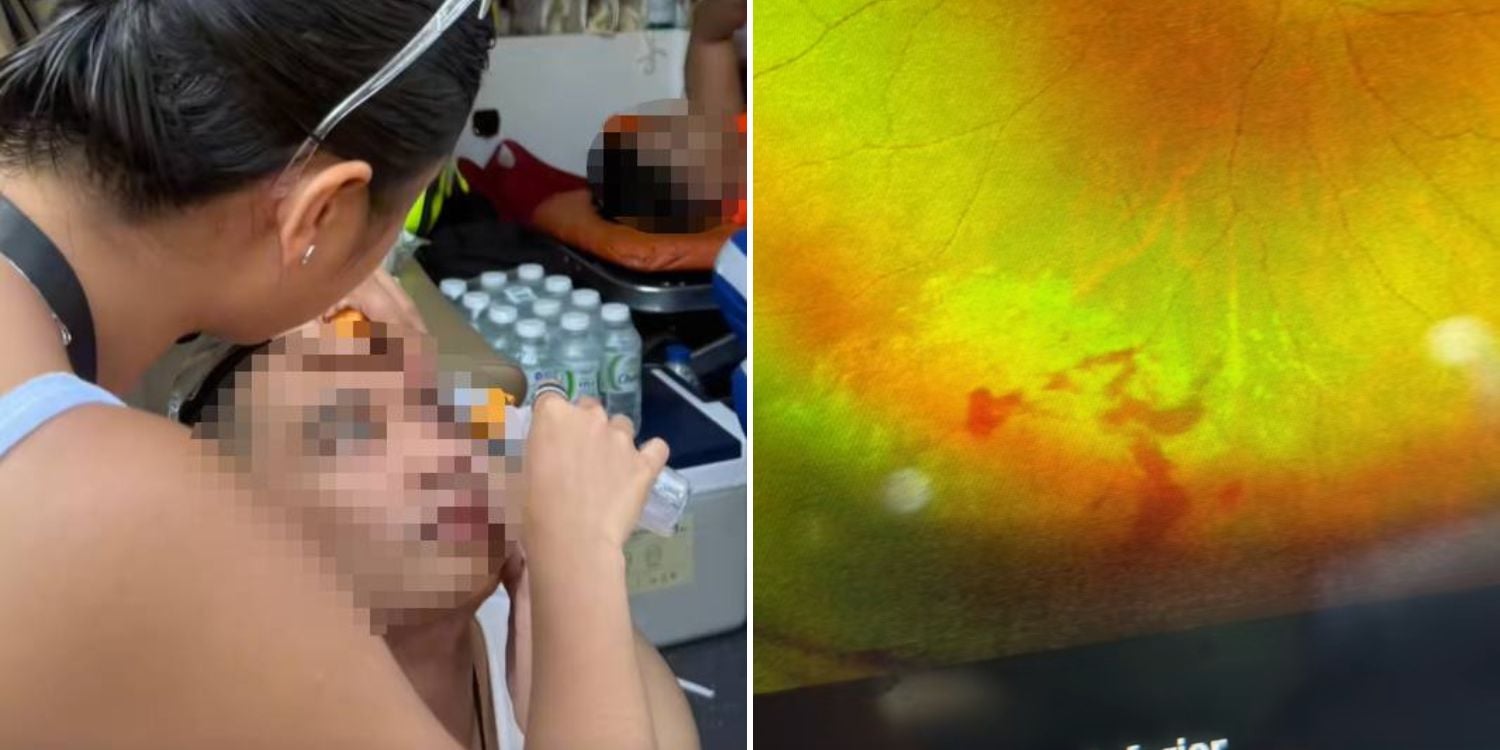 almost went blind songkran