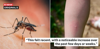 mosquito bites