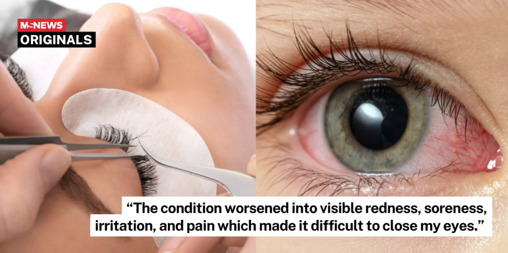 chemical burn lash extension