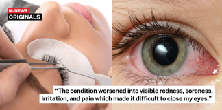 chemical burn lash extension
