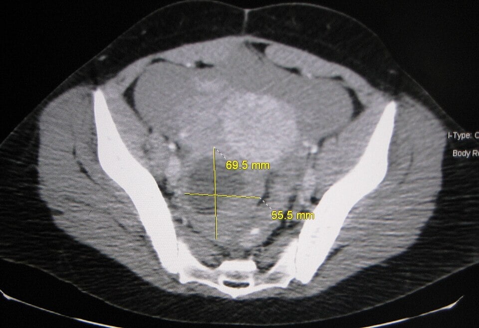 pcos renamed to pmos (2)