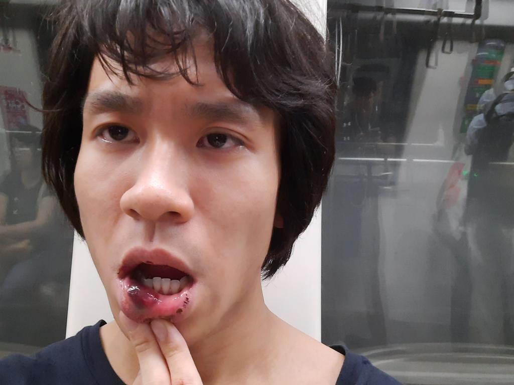 teen charged assaulting Amos yee