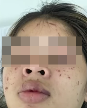 pregnant woman assaulted