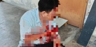 man hacks brother