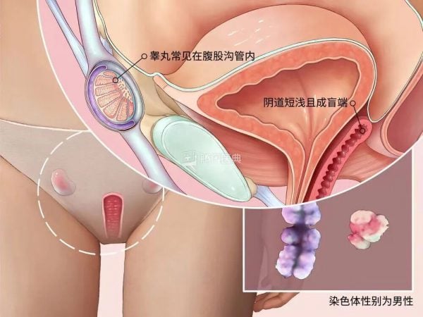 woman biologically male