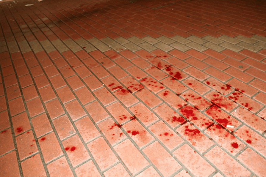 man stabbed neck