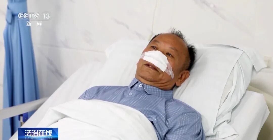 man loses nose