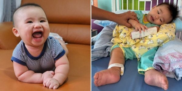 SMA treatment
