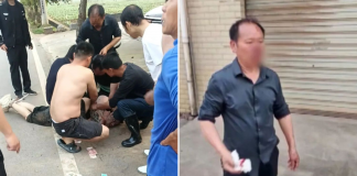 man loses nose