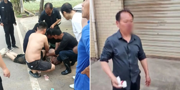 man loses nose