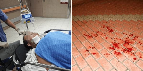 Man stabbed in the neck after dispute over payment at suspected sex service flat in Hong Kong