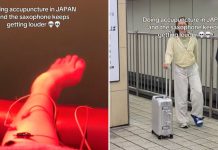nerve damage acupuncture japan