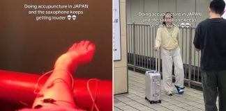 nerve damage acupuncture japan