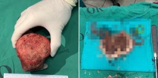 woman mystery object