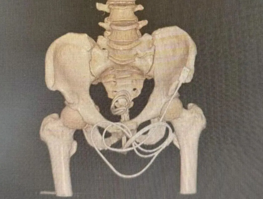 charger cable bladder