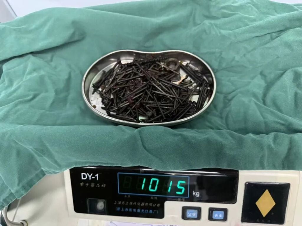 iron nails stomach (1)