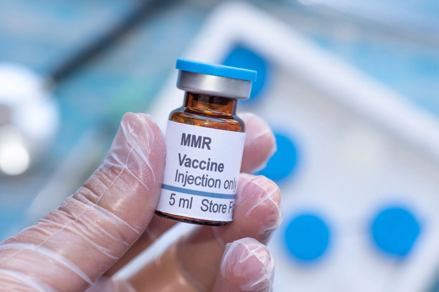measles cases singapore