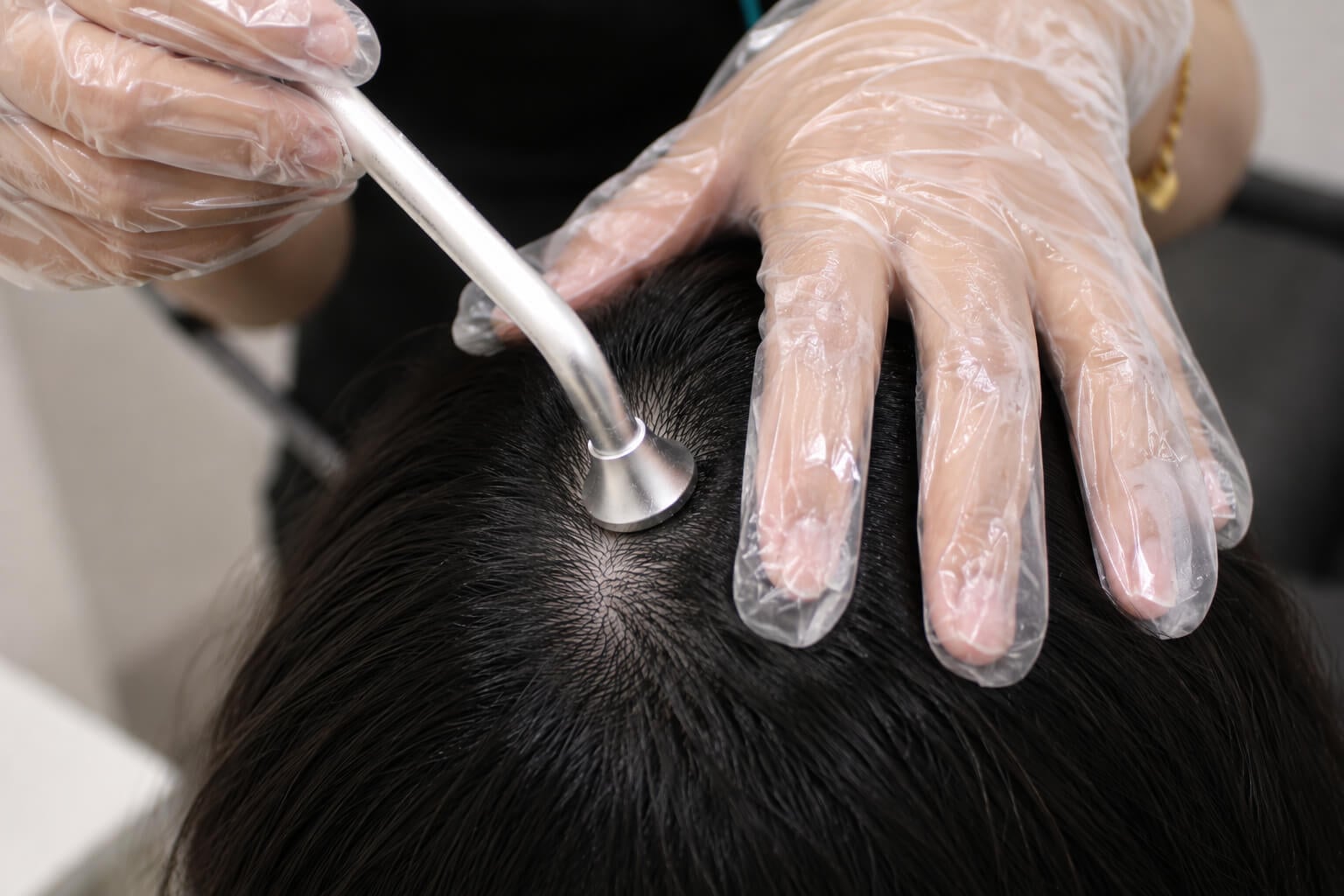TrichoKare Exosome Scalp Renewal Therapy