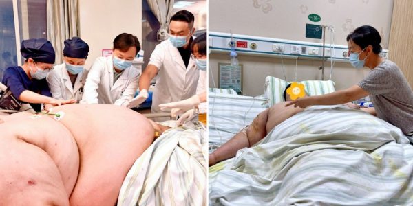 317kg man china