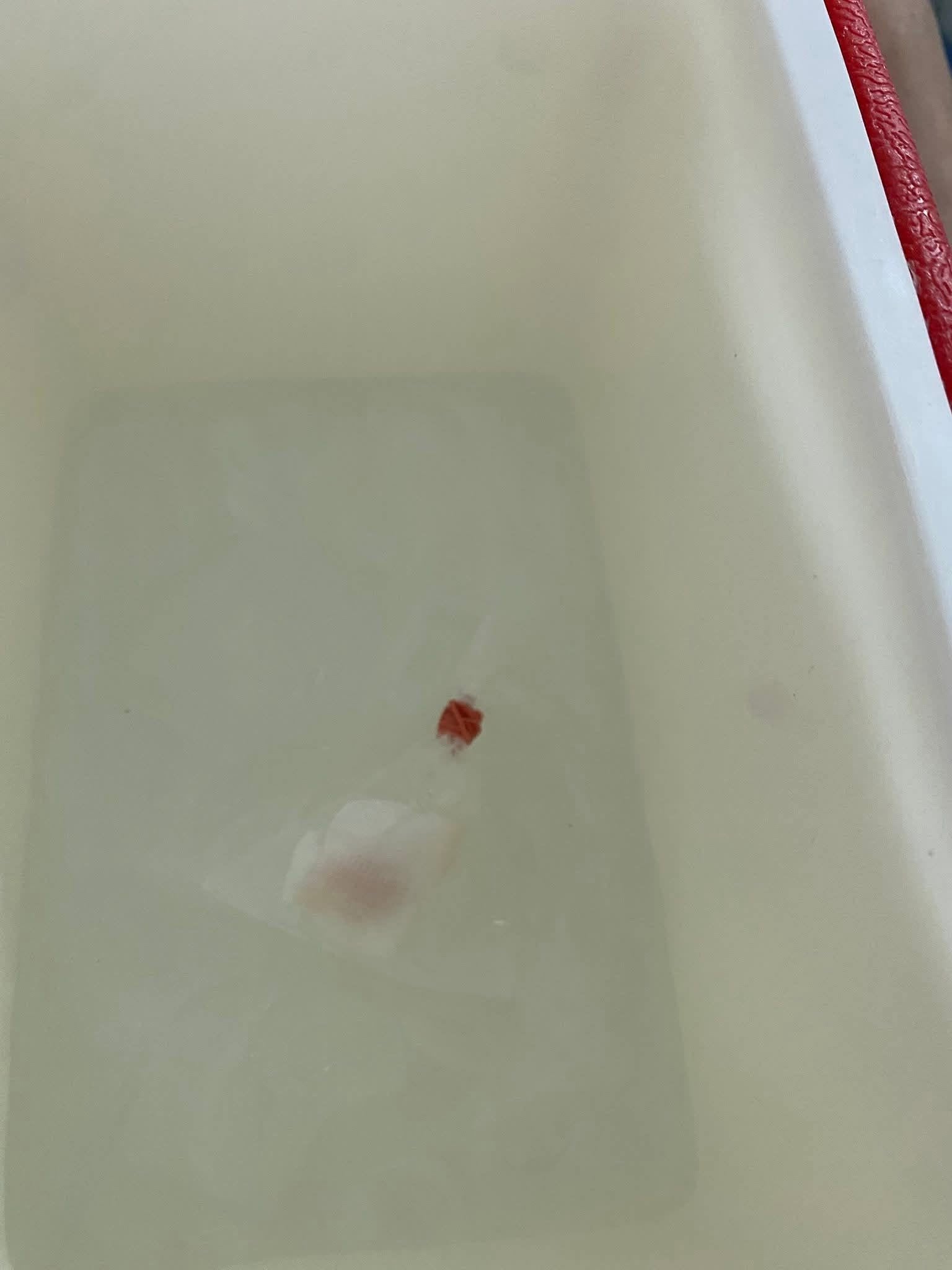 boy finger cut
