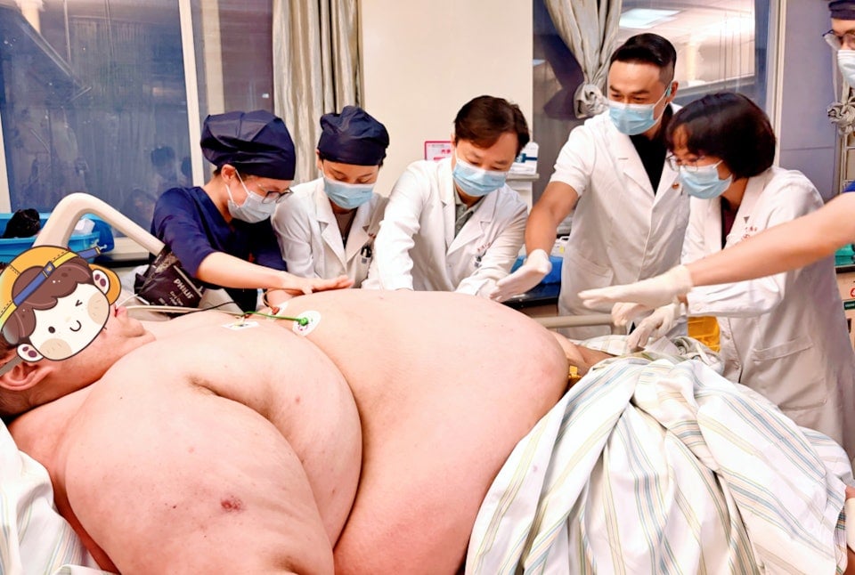 317kg man china