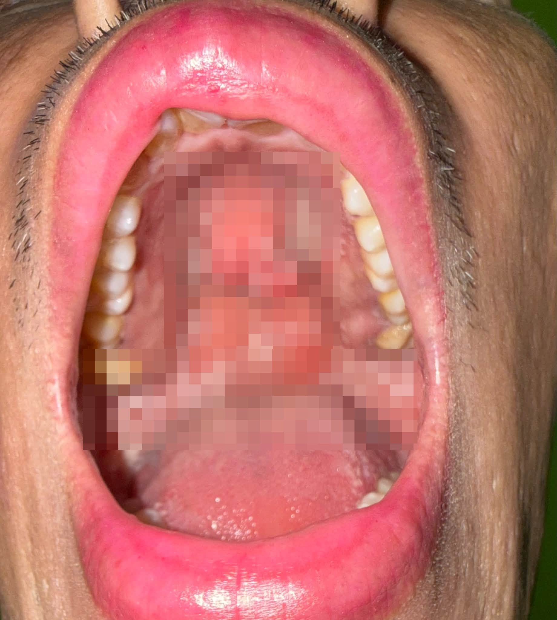 thailand man hiv