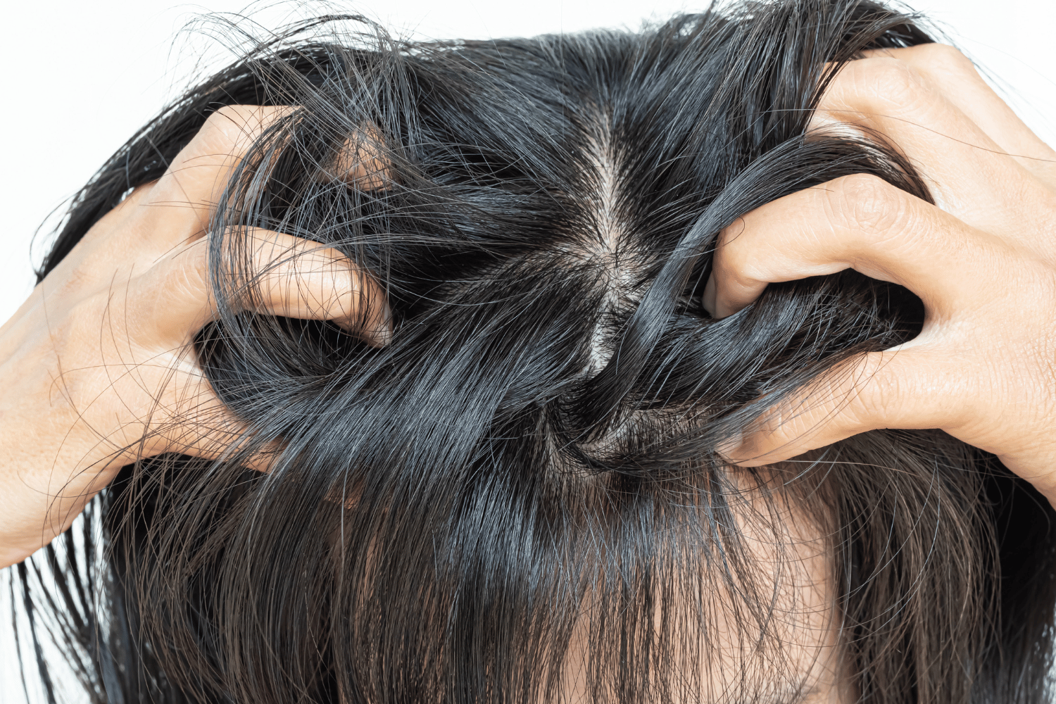 scalp health