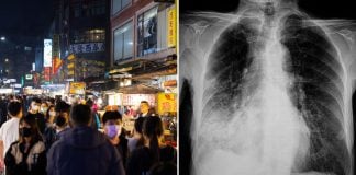 taiwan monitors pneumonic plague