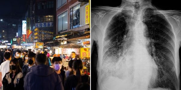 taiwan monitors pneumonic plague